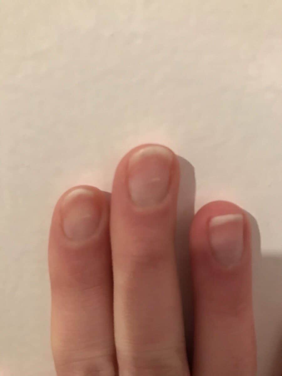 Piano Playing and Fingernail Length – Piano Bubble